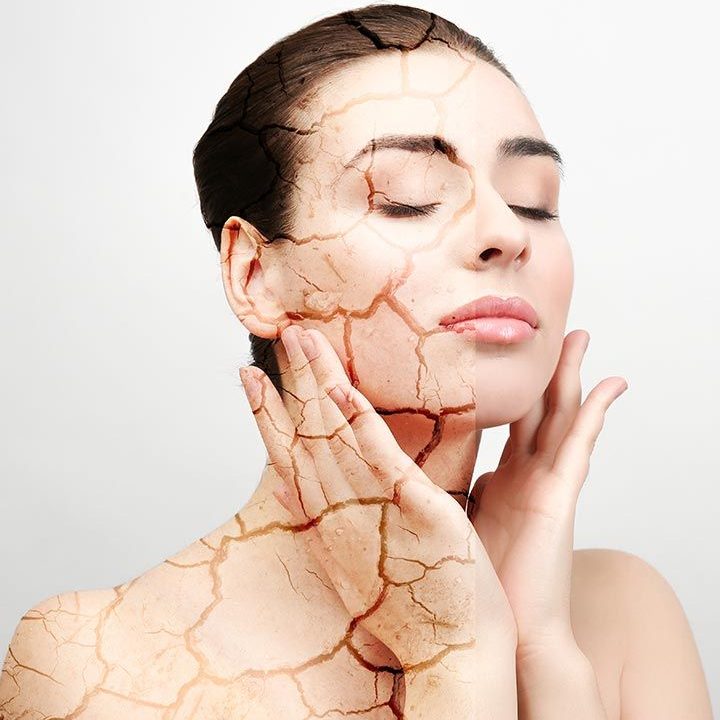 راهکارهای مراقبتی برای پوست خشک