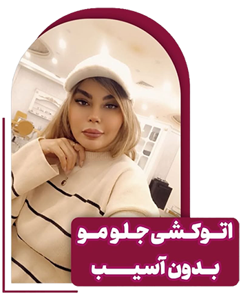 سلما تراپیست مو