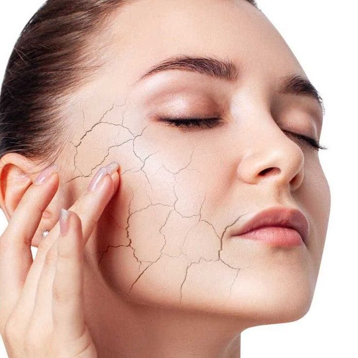 تفاوت پوست دهیدراته با خشک؛ چگونه تشخیص دهیم؟